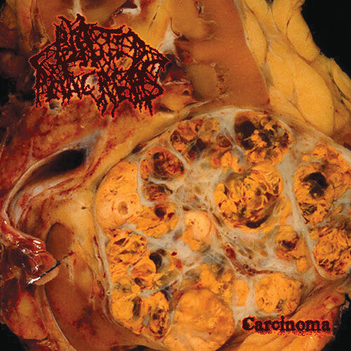 Blasted Pancreas - Carcinoma (Red Colored Vinyl)